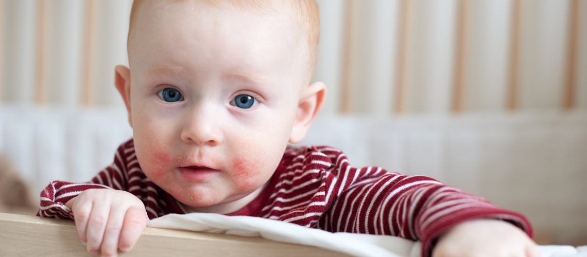 Comment réagir en cas d'allergie chez un bébé ?